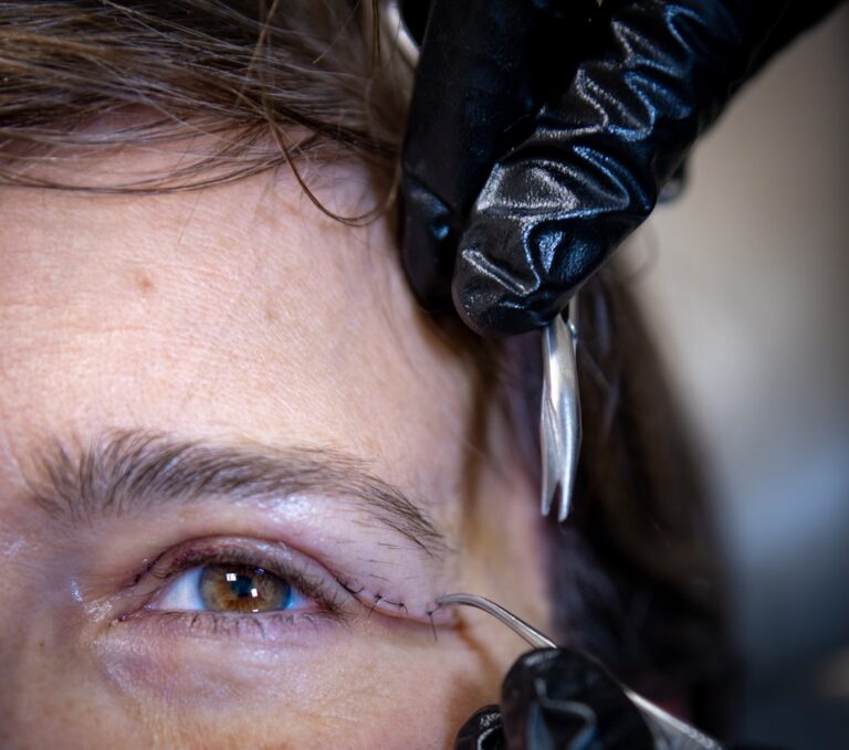 ptosis repair